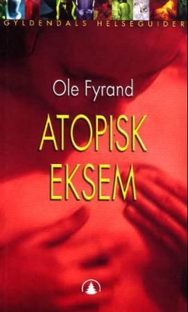 Atopisk eksem