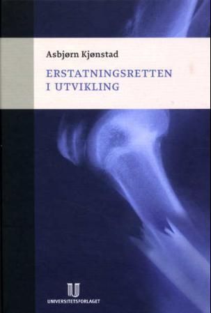 Erstatningsretten i utvikling