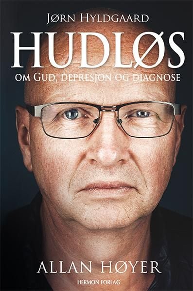 Hudløs