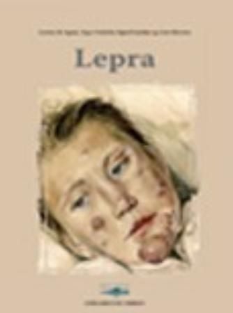 Lepra