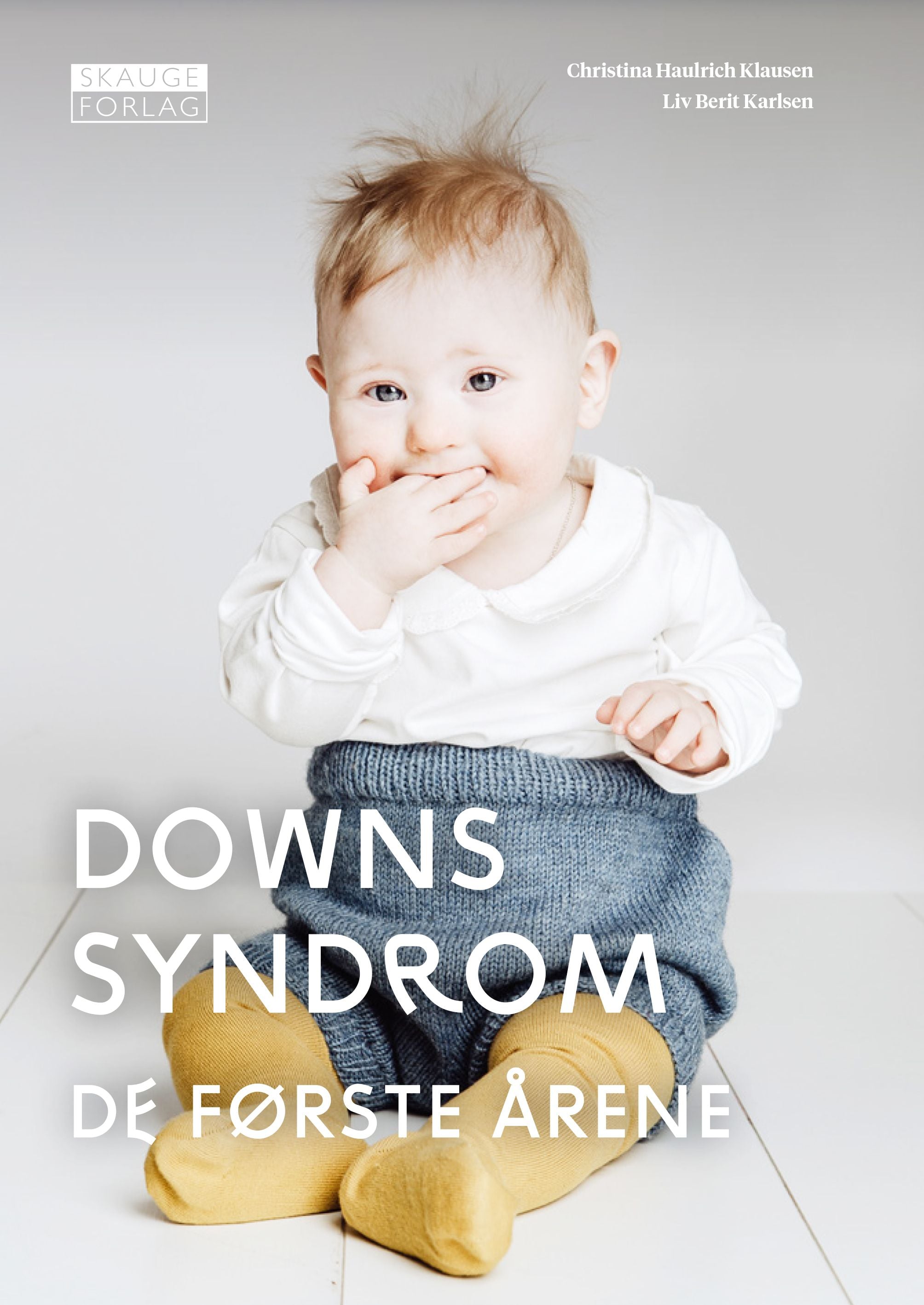 Downs syndrom